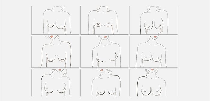 From Breast Shape Dictionary - ThirdLove