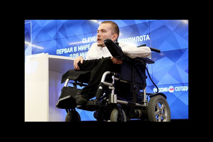 世界初の「頭部移植手術」にゴーサイン、2017年ついに実施へ！