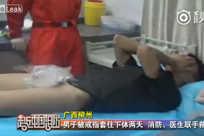 【決死のレスキュー】チンチンに結婚指輪をハメた男、2日後に救出される！