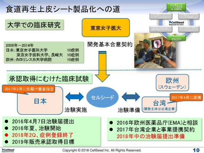 セルシード、上期売上高は3.4億円　食道再生上皮シートは症例登録終了