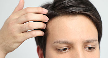 薄毛・抜け毛が気になる皆さまへ「アロエ育毛液」お試し品４点セット