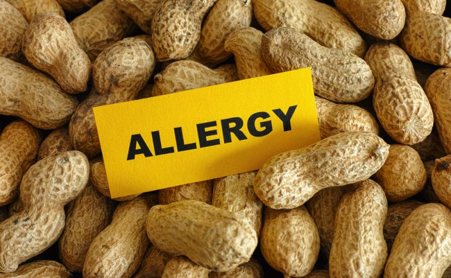 ピーナッツアレルギーが世界的に増加、先進国では3％の幼児に発症