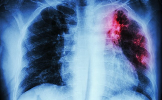 shutterstock_259114169 copy