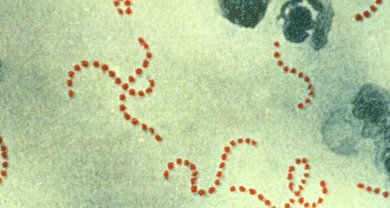 Streptococcus_pyogenes copy