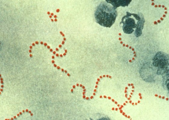 日本で「人食いバクテリア」感染が過去最多。致死率30%超の恐怖