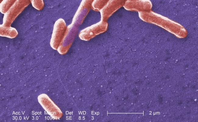 Escherichia_coli_O157-H7_CDC_ID-10071.tif