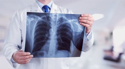 shutterstock_641920864