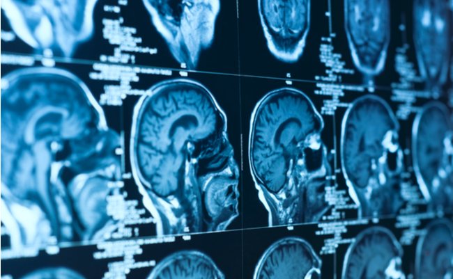 shutterstock_107572736