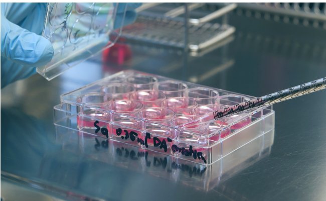 日本の幹細胞再生医療「エビデンスが脆弱」な理由とは？