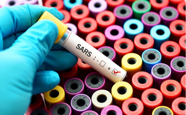 原因不明の謎ウイルスが中国で猛威。あの「SARS」の可能性も？