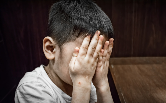 Dirty,Child,Covering,His,Face,With,Both,Hands