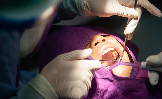 Tooth,Removal,.,Dental,,Dentists,,Dental,Laboratories,In,Low,Light