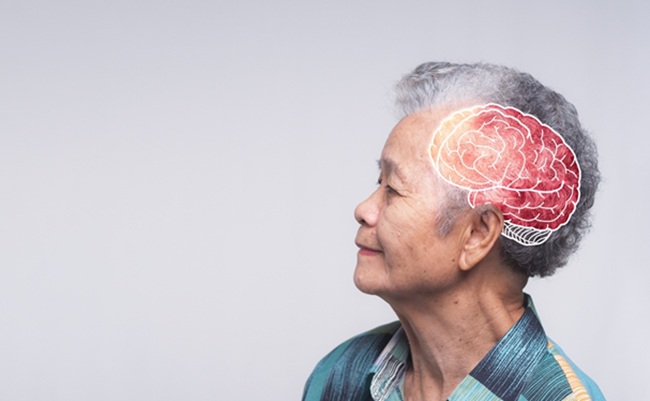 Dementia,In,Senior,People.,Memory,Loss.,Awareness,Of,Alzheimer's,,Parkinson's