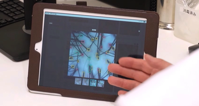 撮影した画像をもとに診断