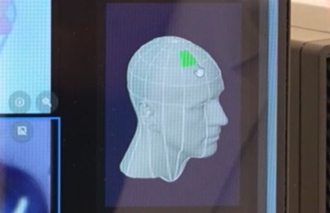 頭皮と頭髪を一度に600枚も3D撮影し、データをAI解析する