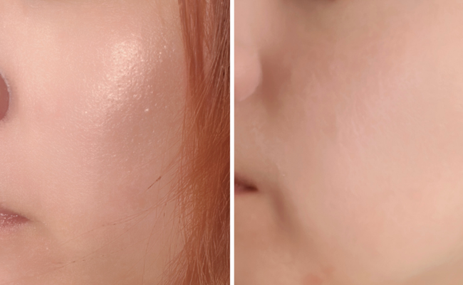 roomie_20260721_kao_spot-serum_09.png